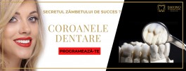 Coroane Dentare - echilibru perfect intre Timp, Calitate și Pret /DAVINCI dental clinic