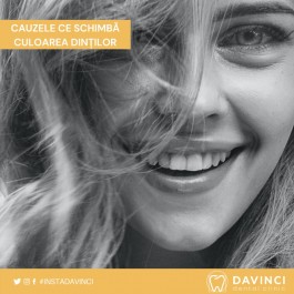 Cauzele ce duc la schimbarea culorii dinților