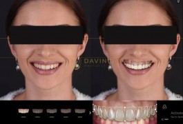 Digital Smile Design