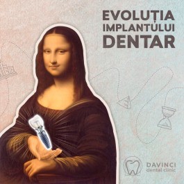 Evoluția implantului dentar