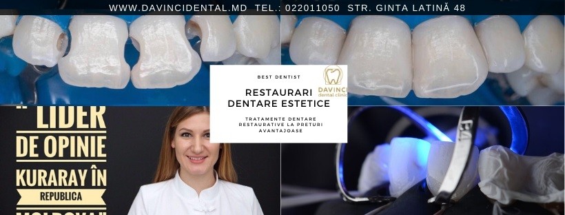 RESTAURARE DENTARA ESTETICA DAVINCI DENTAL CLINIC