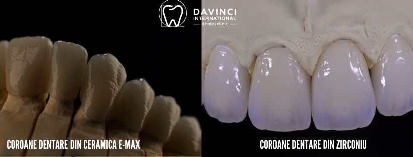 COROANE DENTARE ZIRCONIU DAVINCI DENTAL CLINIC