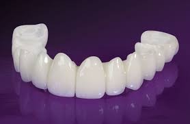 coroana din acrilat davinci dental clinic