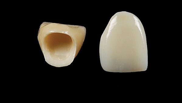 coroane dentara integral ceramice