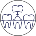 punte dentara