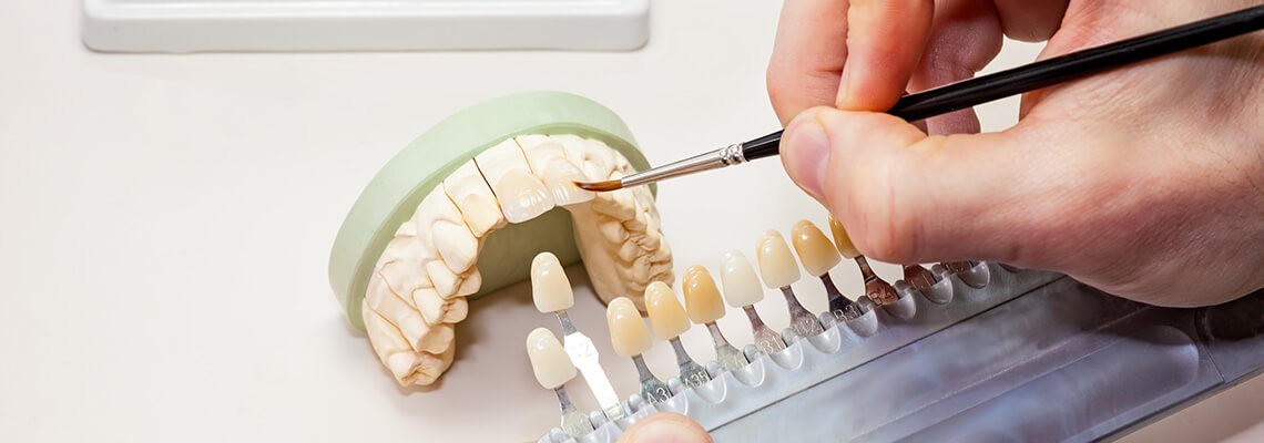 Protezare dentara profesionista de la Davinci dental clinic